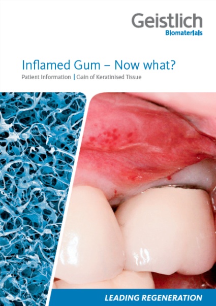 Patient_info_flyer_inflamed_gum