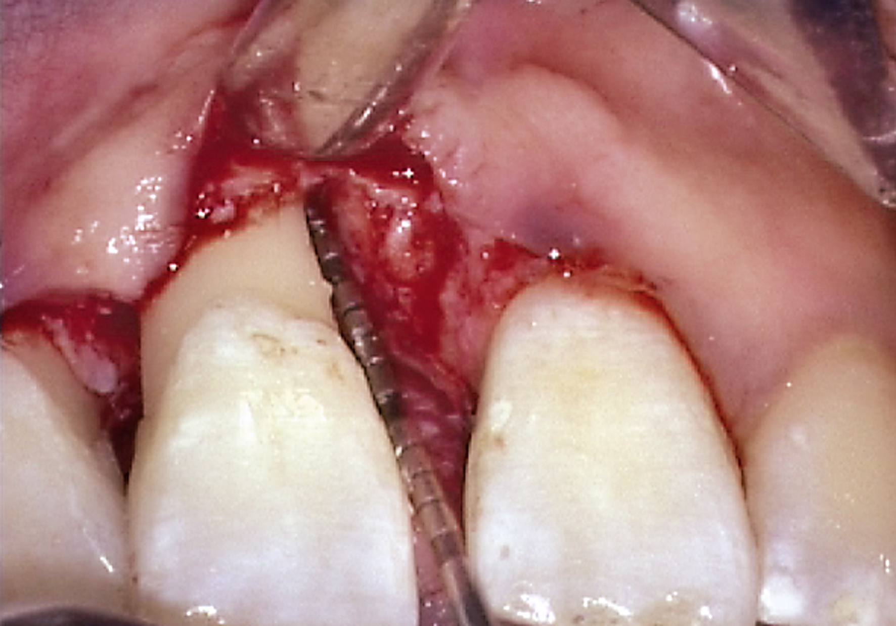 Periodontology