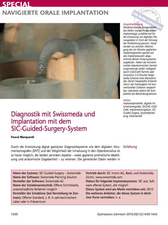 Navigierte-orale-implantation