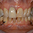 Objectives of basic periodontal therapy