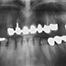 Osseointegration - Part I